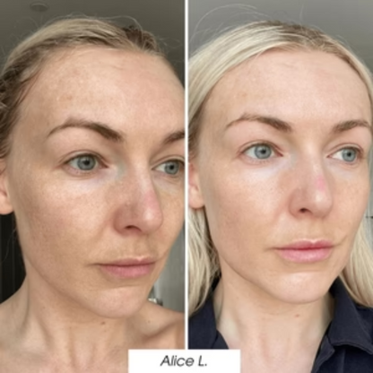 Glowiva - Återfuktar och ger huden glans